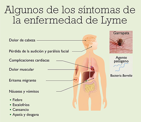 Los síntomas del lyme